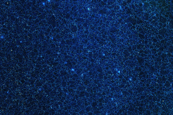 etched microstructure of nickel superalloy Waspaloy imaged through Keyence using darkfield imaging